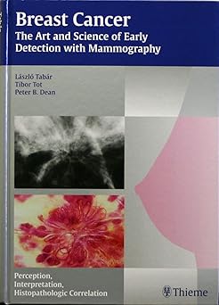 Breast Cancer - The Art and Science of Early Detec