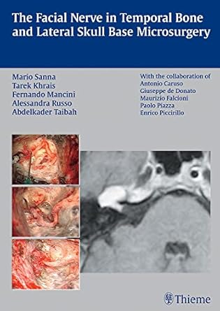 The Facial Nerve in Temporal Bone and Lateral Skul