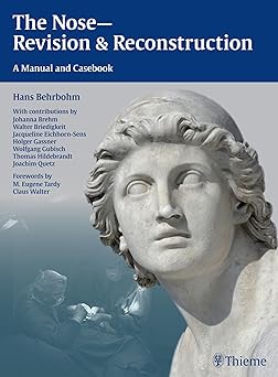 The Nose-Revision & Reconstruction 1st Edition