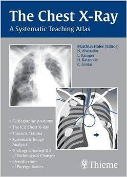 THE CHEST X-RAY (Asian Edition)