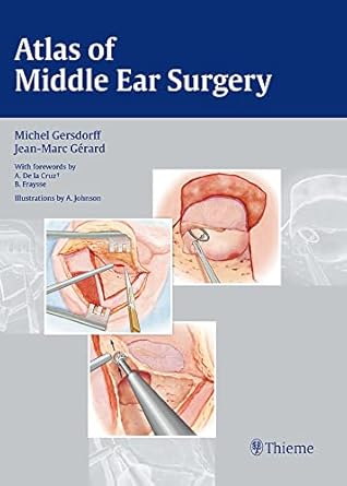 Atlas of Middle ear Surgery