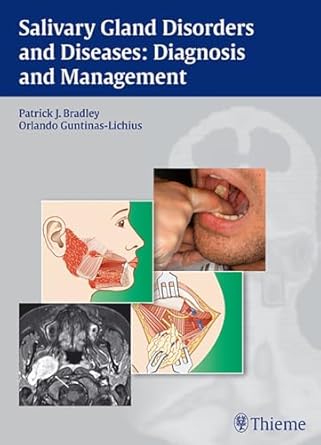 Salivary Gland Disorders and Diseases Diagnosis an