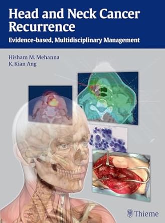 Head and Neck Cancer Recurrence Evidence-based Mul