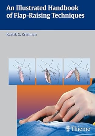 An Illustrated Handbook of Flap-Raising Techniques