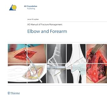 AO MANUAL OF FRACTURE MANAGEMENT ELBOW AND FOREARM