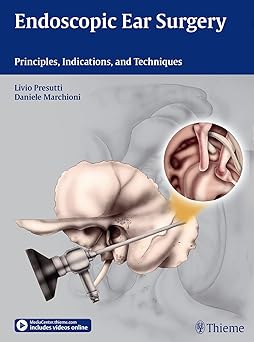 Endoscopic Ear Surgery - Principles, Indications, and Techniques