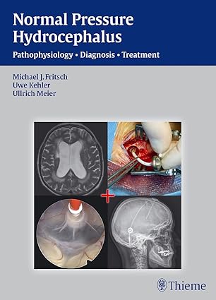 NPH - Normal Pressure Hydrocephalus Pathophysiology - Diagnosis - Treatment