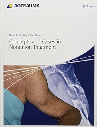 Concepts and Cases in Nonunion Treatment