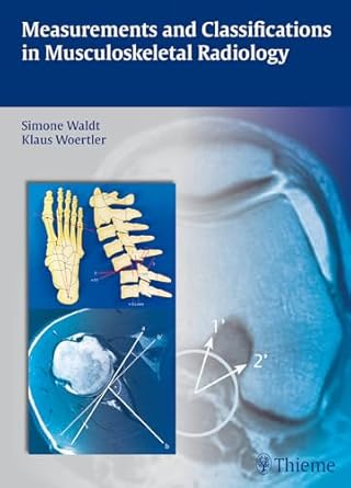 Measurements and Classifications in Musculoskeleta