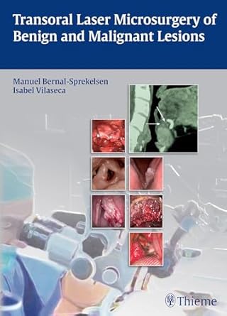 Transoral Laser Microsurgery of Benign and Malignant Lesions 1st Edition