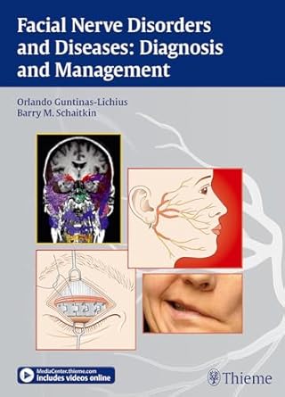 Facial Nerve Disorders and Diseases: Diagnosis and Management 1st Edition