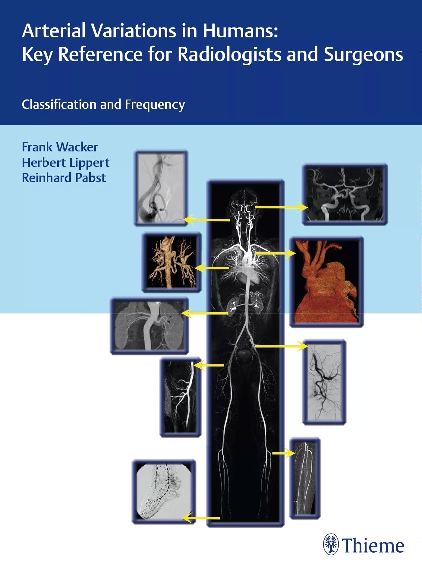 Arterial Variations in Humans