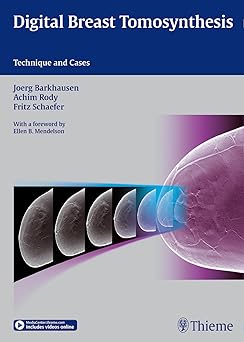 Digital Breast Tomosynthesis