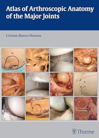 Atlas of Arthroscopic Anatomy of Major Joints 1st Edition