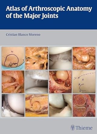 Atlas of Arthroscopic Anatomy of the Major Joints