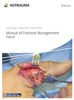 AO Manual of Fracture Management - Hand 1st Edition