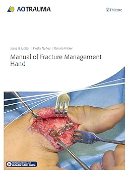 Manual of Fracture Management - Hand
