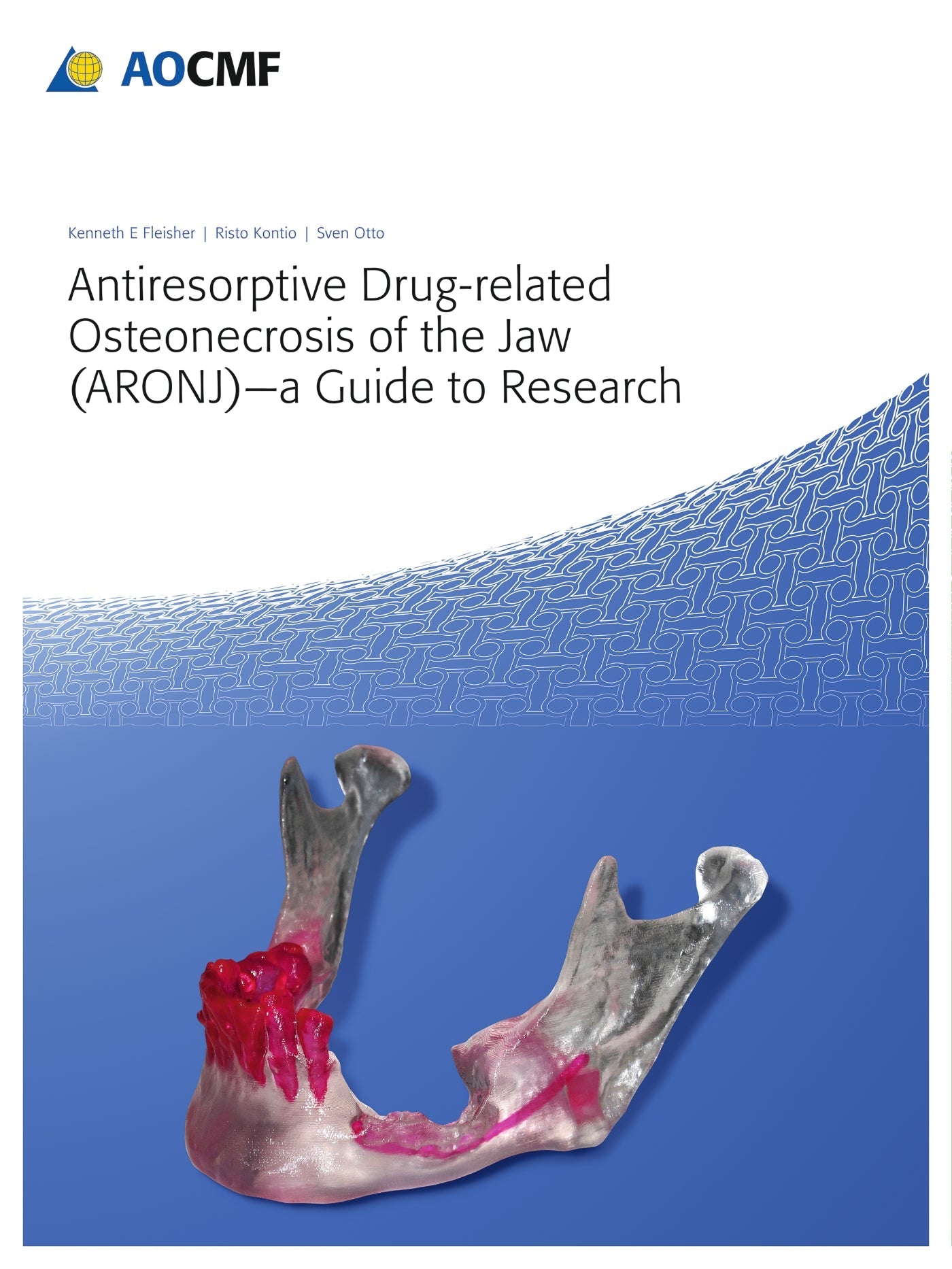 Antiresorptive Drug-Related Osteonecrosis of the Jaw (ARONJ) - A Guide to Research
