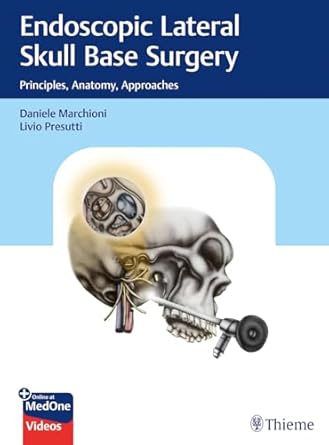 Endoscopic Lateral Skull Base Surgery : Principles, Anatomy, Approaches 1st Ed.