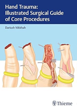 Hand Trauma: Illustrated Surgical Guide of Core Procedures 1st Ed.