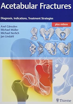 Acetabular Fractures 1st Edition