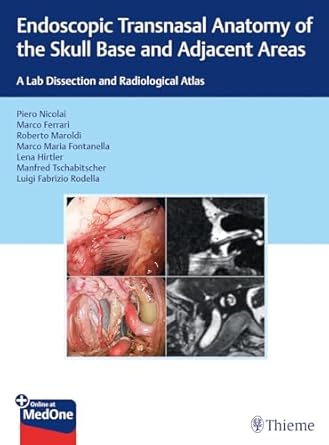 Endoscopic Transnasal Anatomy of the Skull Base and Adjacent Areas 1st Ed.