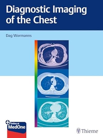 Diagnostic Imaging of the Chest 1st Ed.