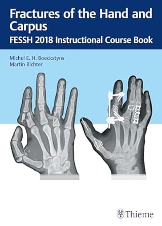 Fractures of the Hand and Carpus Fessh 2018 Instructional Course Book