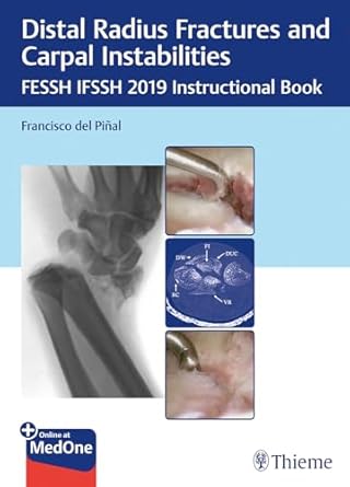 Distal Radius Fractures and Carpal Instabilities 1st Ed.