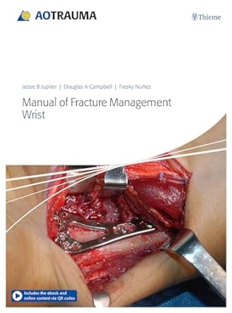 AO Trauma Manual of Fracture Management - Wrist 1st Edition