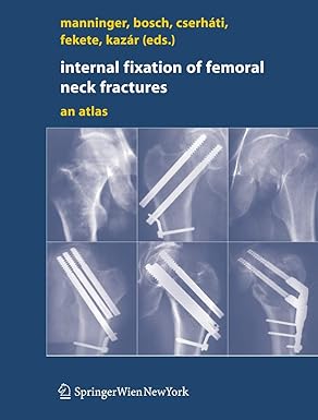 INTERNAL FIXATION OF FEMORAL NECK FRACTURES AN ATLAS