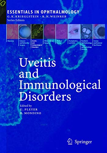 UVEITIS AND IMMUNOLOGICAL DISORDERS