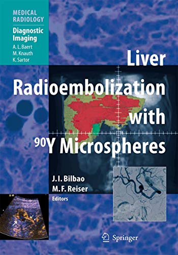 LIVER RADIOEMBOLIZATION WITH 90Y MICROSPHERES
