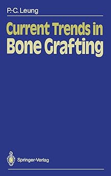 CURRENT TRENDS IN BONE GRAFING