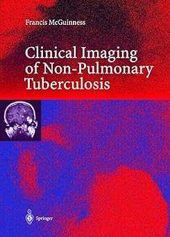 CLINICAL IMAGING OF NON - PULMONARY TUBERCULOSIS