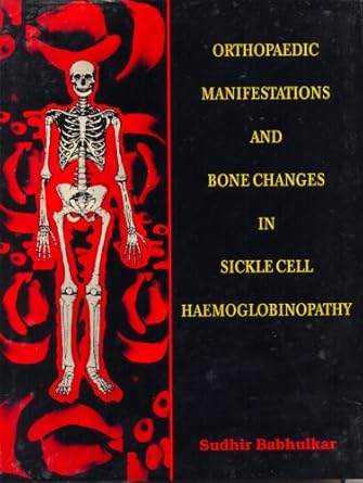 Orthopaedic Manifestations and Bone Changes in Sickle Cell Haemoglobinopathy