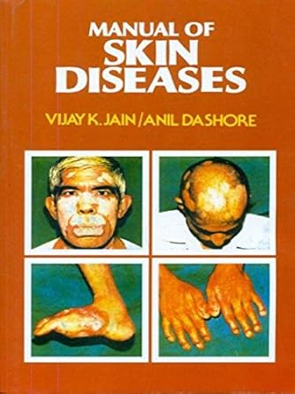 Manual of Skin Diseases