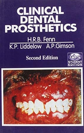 Clinical Dental Prosthetics, 2e (CBS Student Edition)