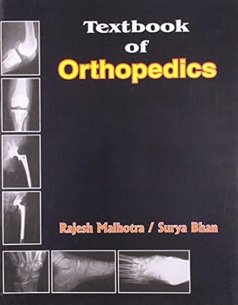 Textbook of Orthopedics