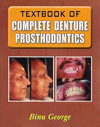 Textbook of Complete Denture Prosthodontics