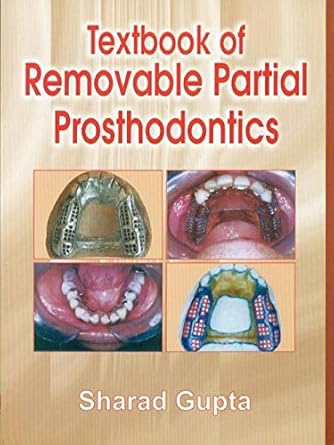 Textbook of Removable Partial Prosthodontics (PB)