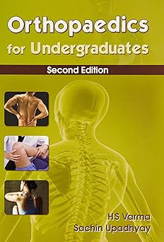 Orthopaedics for Undergraduates, 2e