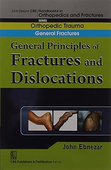 John Ebnezar CBS Handbooks in Orthopedics and Fractures: Orthopedic Trauma: General Fractures: General Principles of Fractures and Dislocations: