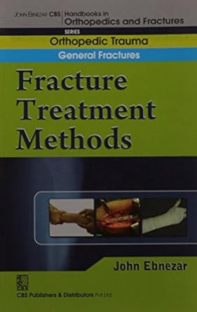 John Ebnezar CBS Handbooks in Orthopedics and Fractures: Orthopedic Trauma: General Fractures: Fracture Treatment Methods