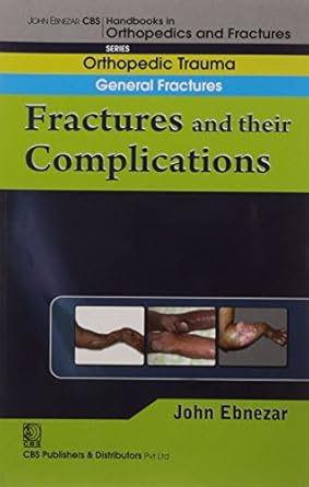 John Ebnezar CBS Handbooks in Orthopedics and Fractures: Orthopedic Trauma: General Fractures: Fractures and their Complications