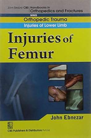 John Ebnezar CBS Handbooks in Orthopedics and Fractures: Orthopedic Trauma: Injuries of Lower Limb :Injuries of Femur