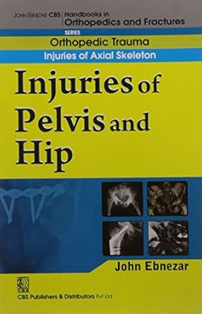 John Ebnezar CBS Handbooks in Orthopedics and Fractures: Orthopedic Trauma: Injuries of Axial Skeleton :Injuries of Pelvis and Hip