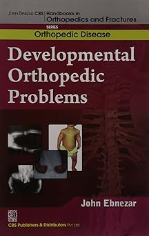 John Ebnezar Series: Developmental Orthopedic Problems