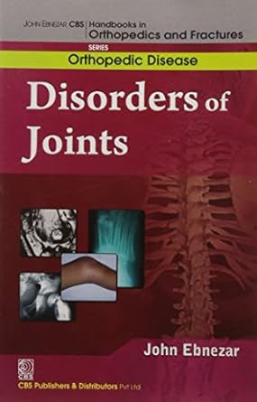 John Ebnezar CBS Handbooks in Orthopedics and Fractures: Orthopedic Disease : Disorders of the Joints