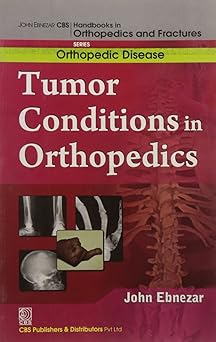 John Ebnezar CBS Handbooks in Orthopedics and Fractures: Orthopedic Disease :Tumor Conditions in Orthopedics